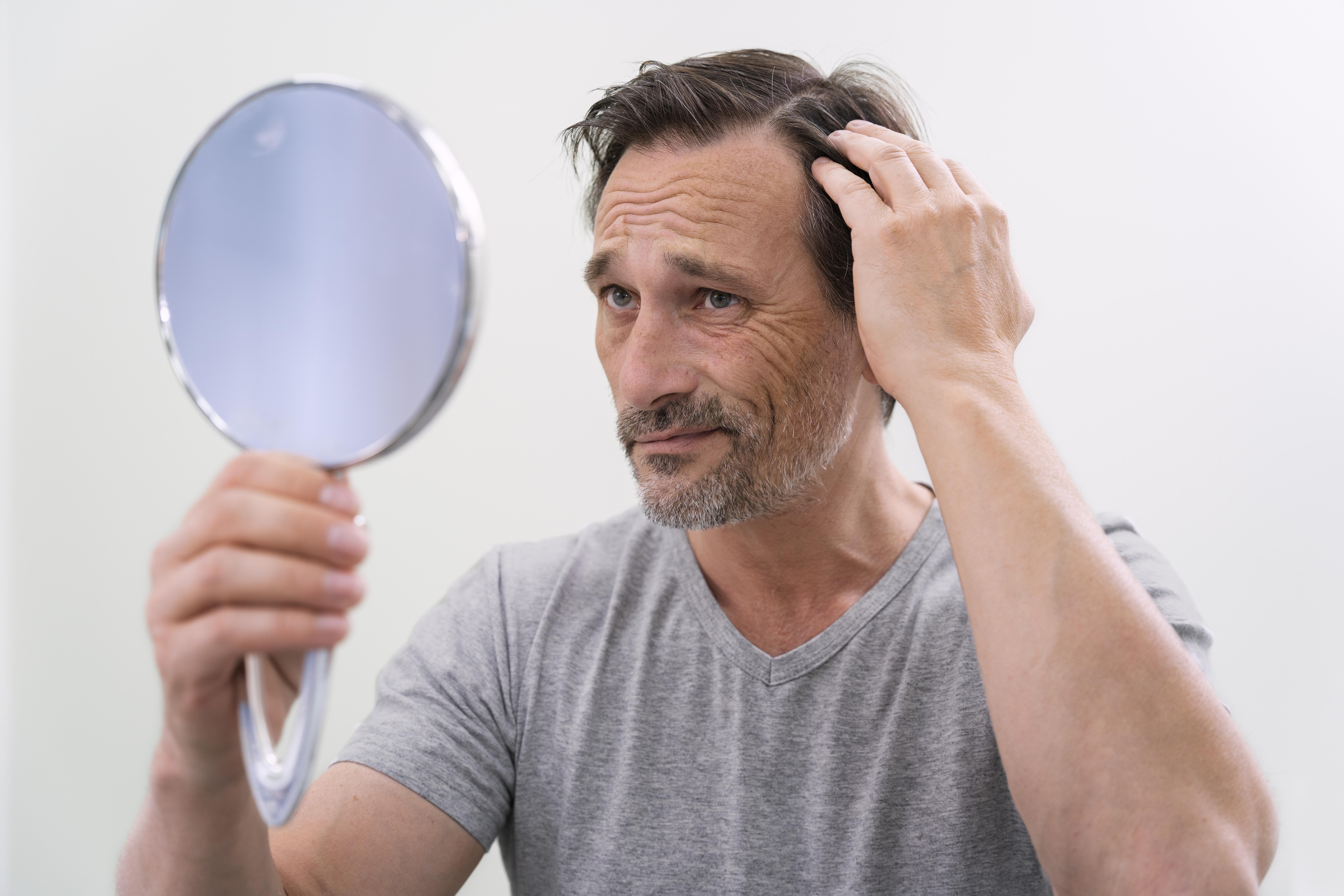  Home remedies to prevent hair loss