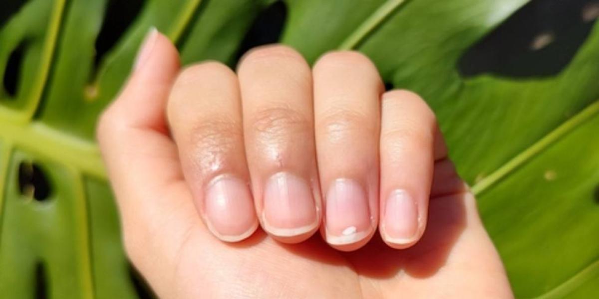White Spots On Nails