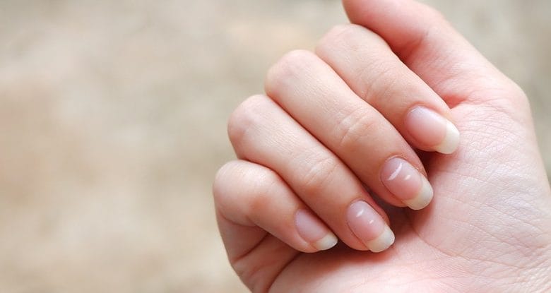 White Spots On Nails