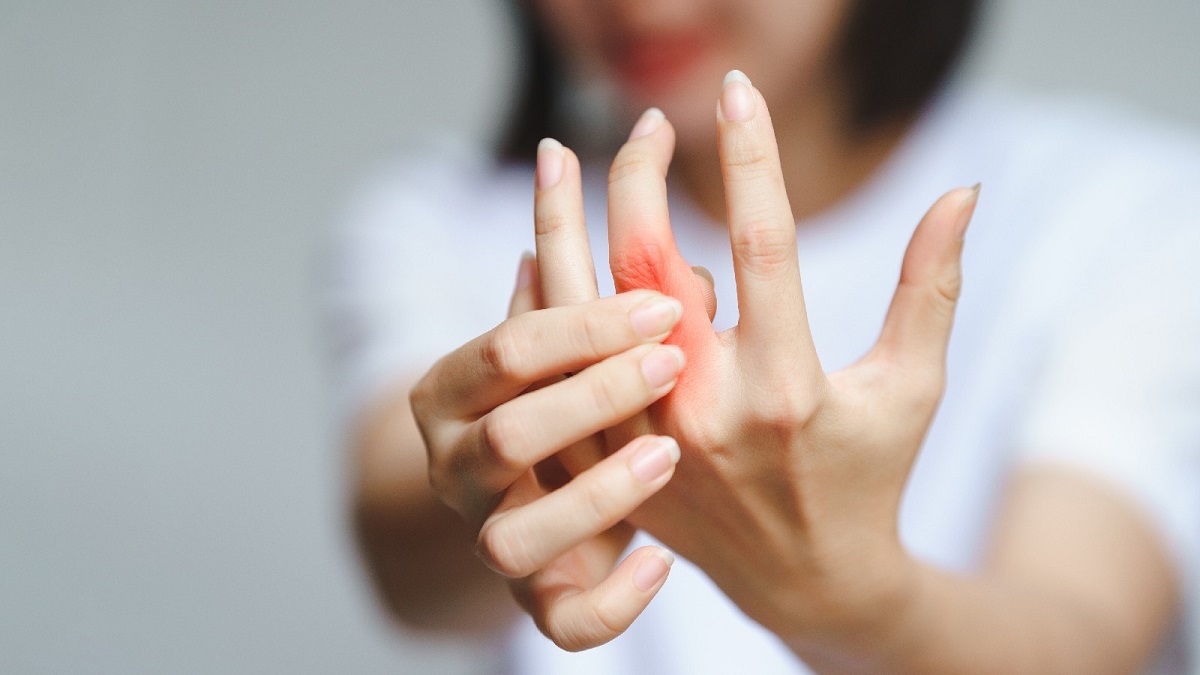 Arthritis In Fingers
