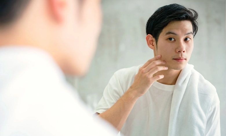 Acne Causes In Men