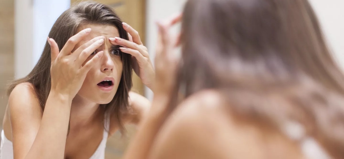 Habits That Worsen Acne