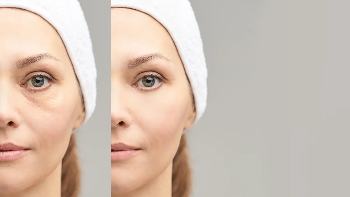 Eye Cream Benefits