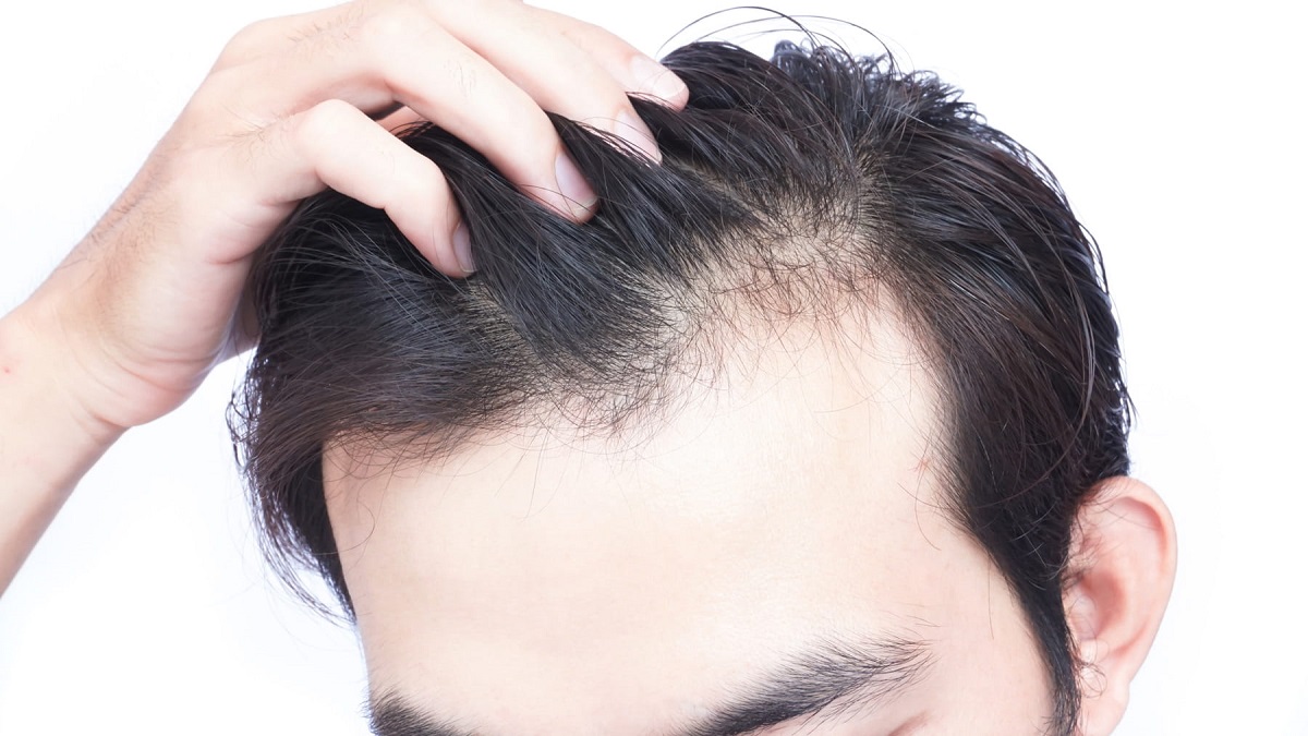 Hair Loss Treatment