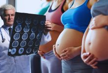 Pregnancy Changes The Brain