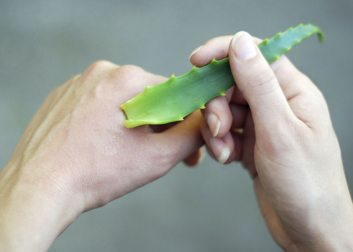 Burns Home Remedies