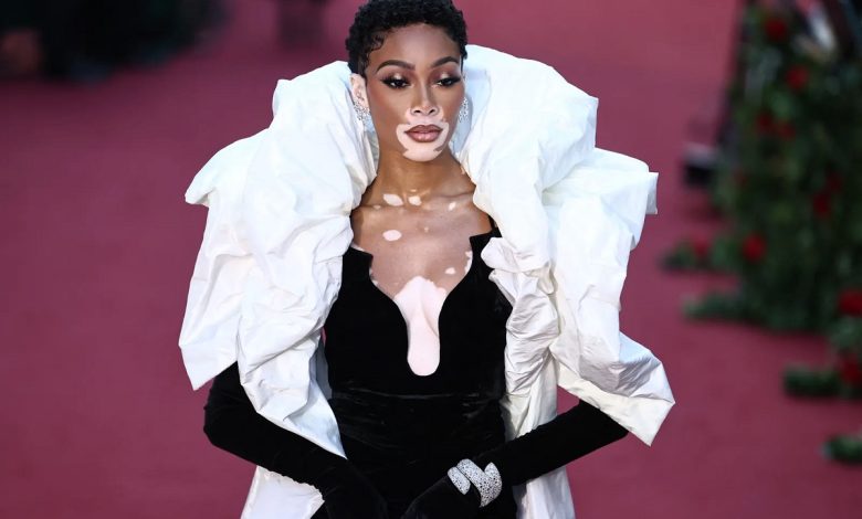 Winnie Harlow Shines At The Earthshot