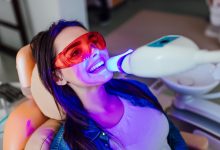 Do's And Don'ts Of Teeth Whitening