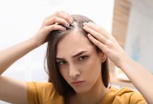 Hereditary Hair Loss