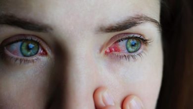 Bleeding Eye Virus