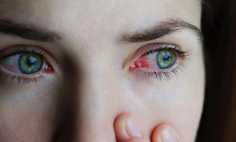 Bleeding Eye Virus