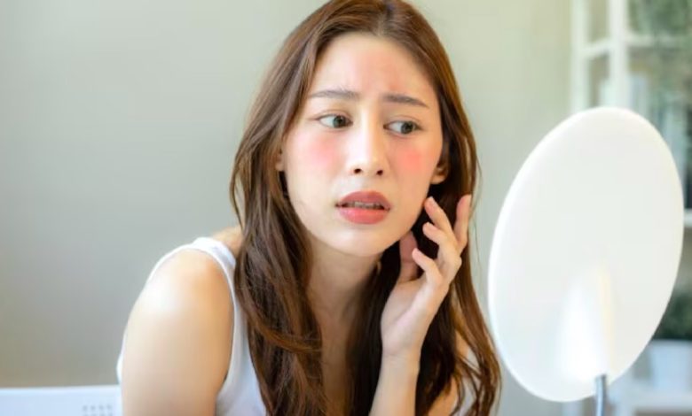 Skin redness causes