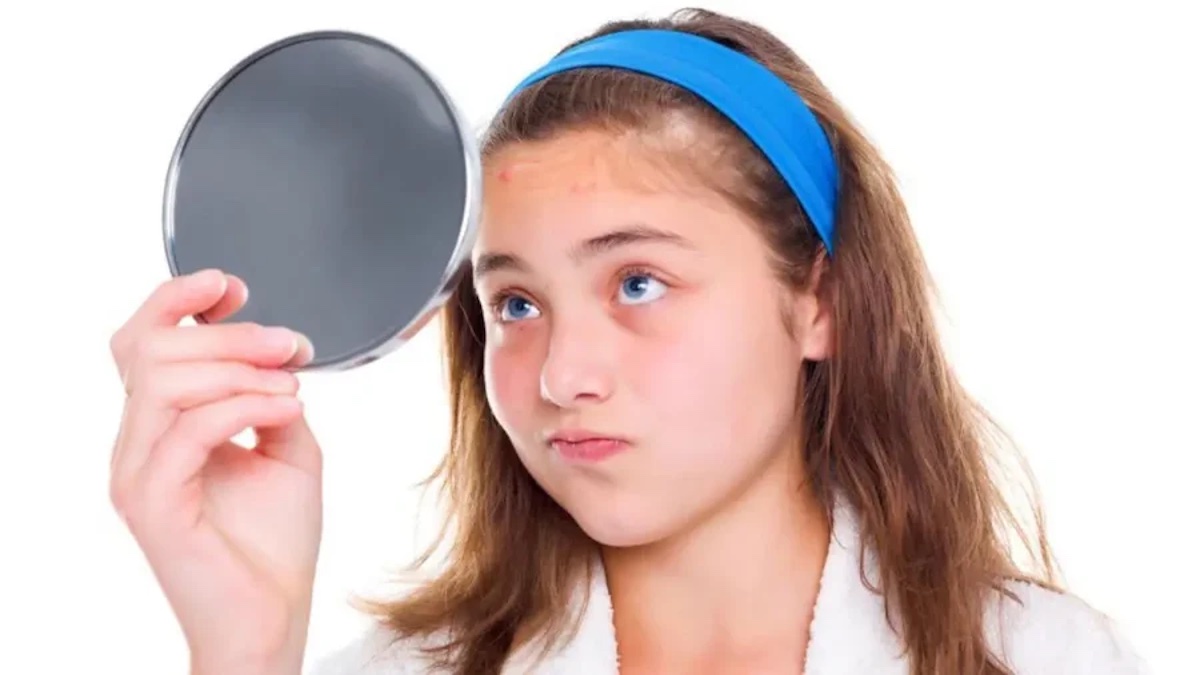 Best skincare tips for teens in summer