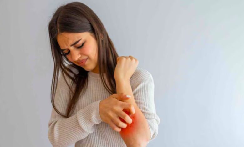 Ways to get relief